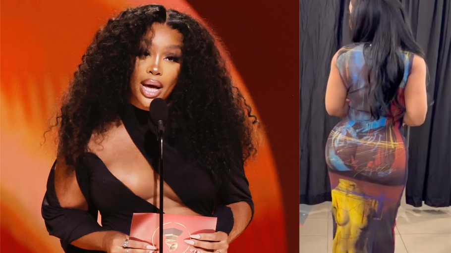 SZA’s BBL Surgery Was Not About Industry Pressure: “I Always Wanted A Really Fat A**”